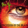 Iron Age | Concussion Of The Brain + Bonus | CD